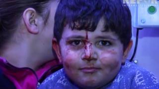 Ermeni zulmüne gülerek karşılık veren çocuk